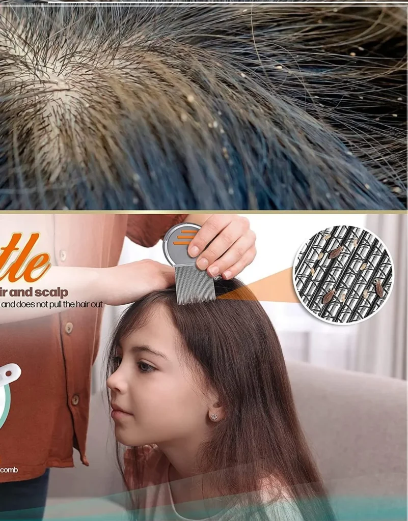 lice comb